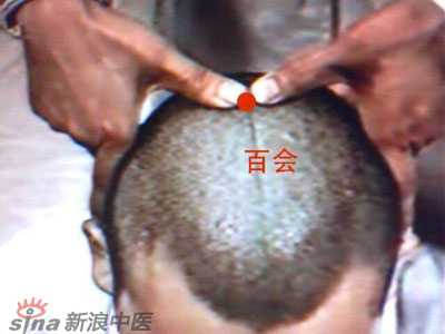 艾灸常用的保健穴有哪些？--百會(huì)