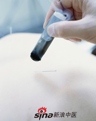 點擊將在新窗口查看全圖 反復咳嗽 試試中醫(yī)特色療法