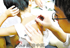 灸法的種類  你知道多少？